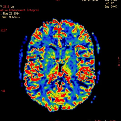 Diagnostično slikanje z radioizotopi Diagnostično slikanje z radioizotopi